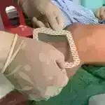 Alimlər xəstələrdə antipsikotik dərmanları aşkar etmək üçün barmaq tərləmə testi hazırlayırlar