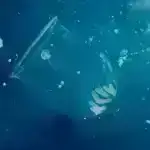 Ana bətnində hormona məruz qalma, sonrakı həyatda miqren riski ilə potensial olaraq əlaqələndirilir