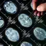 Tibbi tədqiqatda AI-lərin döyüşü: ChatGPT vs Elicit