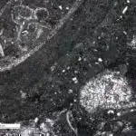 Tədqiqatçılar Alzheimer xəstəliyinin təsirini geri qaytarmaq üçün mümkün həll yollarını kəşf edirlər