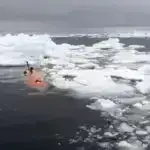 Sökülən beyin şişlərinin toxumlarının izləri necə relaps edir