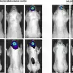 Zərurət və ya zövq üçün yemək? Bunun üçün beyin dövrəsi var