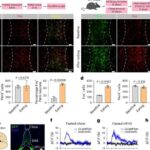 Tədqiqat 40Hz sensor stimullaşdırmanın beynin “ağ maddəni” qoruya biləcəyi yolları ortaya qoyur