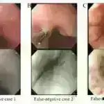 Tədqiqat göstərir ki, ağdərili qərbli qadınların bədəni daha aşağıdır və arıq görünmək üçün media təzyiqi daha yüksəkdir
