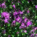 Dünyanın ən sürətli tək çəkilişli 2D təsvir texnikası alovda ultra sürətli dinamikanı lentə alır