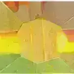 Diaqnostik vasitə uşaqlarda baş sındıran iltihabi xəstəlikləri müəyyən edir