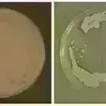 Daha yaxşı cərrah qurmaq: Tədqiqatçılar cərrahi təlim üçün süni intellekt aləti hazırlayırlar