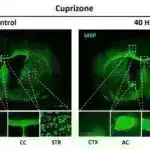 Zərurət və ya zövq üçün yemək? Bunun üçün beyin dövrəsi var