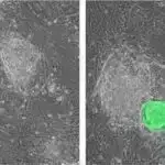 Elektrik sarğı xroniki yaraların müalicəsi üçün vəd edir