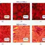 Qan kök hüceyrə araşdırması sümük iliyi nəqlini dəyişdirə bilər