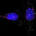 Siçan araşdırması göstərir ki, bir əsas genin yox edilməsi autizm əlamətlərinə gətirib çıxarır