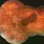 Elm adamları niyə bəzi planetlərin yüzlərlə peyki olduğunu, digərlərində isə heç olmadığını hələ də tam başa düşə bilmirlər