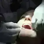 Tədqiqat makrofagların ağciyər fibrozunda səhv başa düşülən rolunu ortaya qoyur