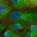 Proteostazın açılması: Alzheimer kimi neyrodegenerativ xəstəliklərlə mübarizədə yeni bir sərhəd