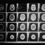 Kişilərdə testosteron səviyyəsini tənzimləyən super ferment “dəli” quş növlərində aşkar edilmişdir