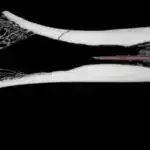 Hüceyrələri viruslardan qoruyan unikal genetik mexanizm kəşf edildi