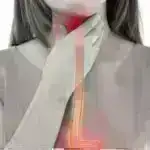 Sosial proqram Braziliyanın ən yoxsulları arasında vərəm hallarını yarıdan çox azaldır