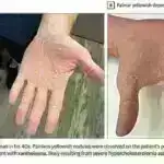 Daha yaxşı məhsul inkişafı üçün göbələk mikrobiomlarından istifadə