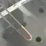 Süni intellektə əsaslanan hamiləlik təhlili ölü doğum və yeni doğulmuş ağırlaşmalar üçün əvvəllər məlum olmayan xəbərdarlıq əlamətləri aşkar edir