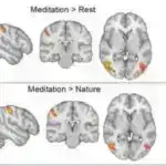 Genetik xəstəliklərin qarşısını almaq üçün embrionların redaktə edilməsi: Tədqiqat etik mübahisələrə səbəb olur