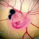 Niyə 2024 YR4 asteroidinin 2032-ci ildə Yerlə toqquşması ehtimalı azdır və alimlər bunu necə izləyirlər?