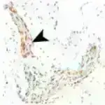 Yeni araşdırma Sudan virusunun insan hüceyrələrinə necə bağlandığını ortaya qoyur