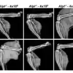 Alimlər insan beynində böyrək və qaraciyərdən daha çox mikroplastik tapıblar və onların səviyyəsi yüksəlir