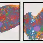 Yeni kəşf edilmiş biomarker xərçəngin aqressivliyini proqnozlaşdıra bilər
