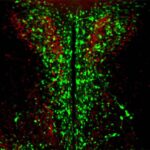 Ananın asetaminofen (parasetamol) istifadəsi plasental gen ifadəsini dəyişdirərək uşaqlarda DEHB riskini artırır