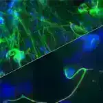 Öz-özünə işləyən qrafen ağıllı sensoru yara monitorinqi zamanı ağrıları aradan qaldırır