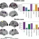 Bu, təkcə nə dediyiniz deyil, həm də onu necə dediyinizdir: Beyin nitqin yüksəkliyindəki dəyişiklikləri necə deşifrə edir