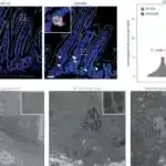 Nekrotik hüceyrələr bədənin bərpası prosesinə necə kömək edir