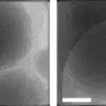 Beyin kanalları “vaxtında dayanıb” öyrənməyə və düşünməyə imkan verən kimyəvi axını aşkar edir