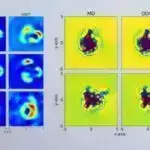 Tədqiqatın nəticələrinə görə, hətta yüngül COVID-19 ürək-damar sistemində balanssızlığa səbəb ola bilər