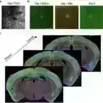 Tədqiqatlar göstərir ki, maşın öyrənmə modelləri əsas sağlamlıq pozuntularını aşkar edə bilmir