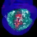 Diaqnostika texnologiyası üç saat ərzində patogenin müəyyən edilməsində 100%-ə yaxın dəqiqliyə nail olur