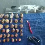 Ümumi anesteziya beynin funksional “barmaq izinin” unikallığını azaldır, araşdırma tapır