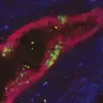 Probiyotiklər mənfi hissləri azaldır və potensial psixi sağlamlıq faydaları təklif edir