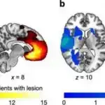 İlk “ağıllı”, geyilə bilən, uşaq yumşaq ekzoskeleti motor problemləri olan uşaqlar üçün hərəkətlilik təmin edir