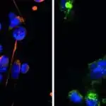 DNT origami mədəaltı vəzi xərçəngi ilə mübarizədə daha dəqiq təsvirlər təqdim edir