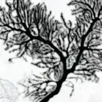 Tədqiqat məqsədsiz antibiotiklərin böyük səviyyələrini ifşa edir