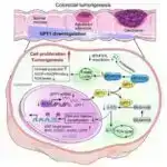 Serebrospinal mayedə tapılan implant mənşəli metallar