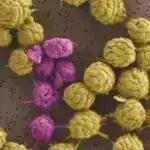 Tədqiqat 19-cu əsrdə raxit və sinqa xəstəliyindən əziyyət çəkən fransız uşağında civə müalicəsini aşkar edib.