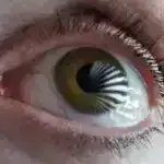 Protein “toxumları” ALS və frontotemporal demansın əsas patoloji xüsusiyyətlərini tətikləyir