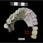 Yeni texnika 1-ci tip diabet xəstələrinə transplantasiya üçün insulin istehsal edən adacık hüceyrələrinin “arxitekturasını” qoruyur.