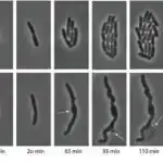 18 illik tədqiqatın nəticələrinə görə, evlilik yaşlı yetkinlərdə daha yüksək demans riski ilə əlaqələndirilir