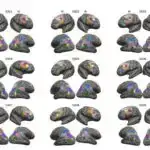 4 hiperhəssaslıq pnevmonitindən 1-i ilə əlaqəli məişət qəlibi