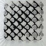 Tədqiqat testi 1-ci tip diabetə səbəb olan otoimmün hücumun ən erkən mərhələlərini aşkar edir, elm adamları bildirirlər