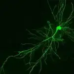 Yuxuda yatan arıların beyin fəaliyyəti insanın yuxu və yaddaş pozğunluqlarını xəbərdar edə bilər