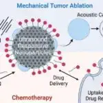 Magellan missiyası Venerada mümkün tektonik aktivliyi aşkar edir